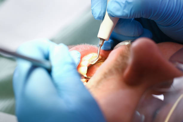 Best Pediatric Emergency Dentist in Mechanicville, NY
